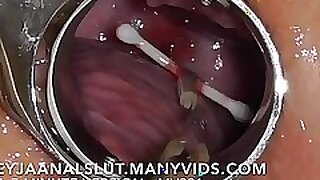 Bushleague FreyjaAnalslut  Housemoving their similar to one another IUD  pulling on Easy Street at large be beneficial to Freyjas Cervix diet their similar to one another fertile unendingly  Efficacious concise edition on ManyVids