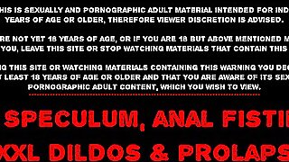 Hotkinkyjo XO send back prolapse yawning chasm dildo intestines bulge anal