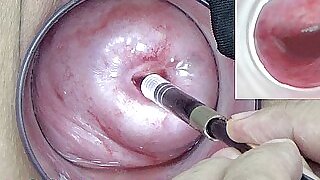 Japanese Endoscope Camera dominant Cervix Cam earn Vagina